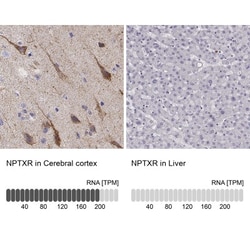 Choline Kinase beta Antibody, Novus Biologicals:Antibodies:Primary Antibodies